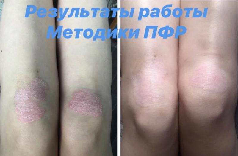 Психо-функциональная разблокировка